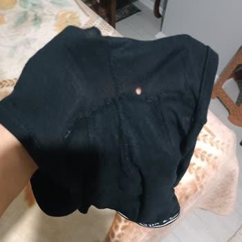 Defolu Boxer Ve Ciltte Kaşıntı Yapan Atlet İçin Değişim İsteği