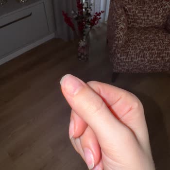 Emsal Doğan Güzellik Merkezi Kalıcı Oje Çıkarma İşleminde Şiddetli Acı Ve Tırnak Zedelenmesi