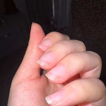 Emsal Doğan Güzellik Merkezi Kalıcı Oje Çıkarma İşleminde Şiddetli Acı Ve Tırnak Zedelenmesi