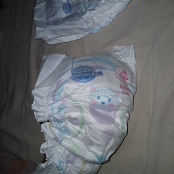 Molfix Bebek Bezlerinde Pamukçuk Parçaları Çıktı, Bebeğin Cildi Kızarıyor