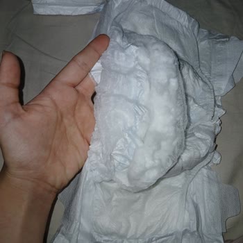 Molfix Bebek Bezlerinde Pamukçuk Parçaları Çıktı, Bebeğin Cildi Kızarıyor