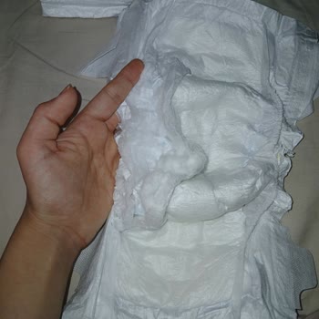 Molfix Bebek Bezlerinde Pamukçuk Parçaları Çıktı, Bebeğin Cildi Kızarıyor