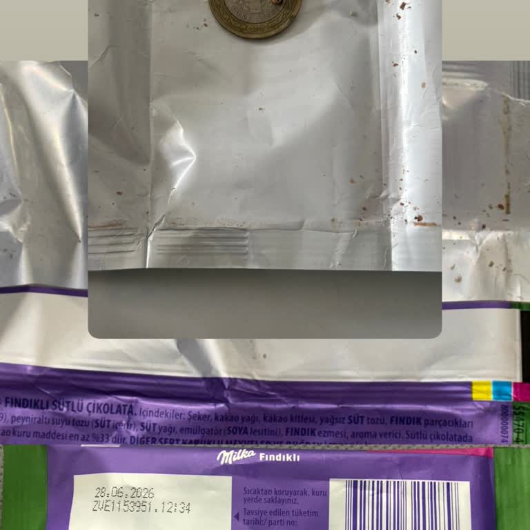 Milka Çikolatasındaki Keskin Fındık Kabuğu Diş Tedavisini Tehlikeye Attı