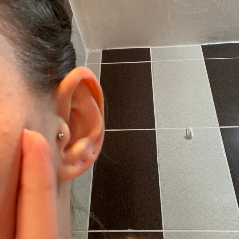 Özensiz Piercing Uygulaması Ve Kampanya Haksızlığı Sonrası Süren Ağrı