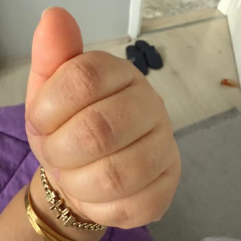 Activex Antibakteriyel Sabun Hassas Ciltlerde Yanma Ve Çatlaklara Neden Oldu