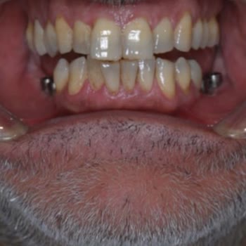 Dt. Damla Zenar Mağduriyet Yaşama