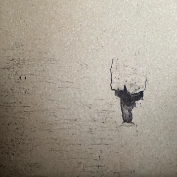 Aşırı Ücretli Hastanede Kötü Bakım Ve Eski Tesis Şikayetleri