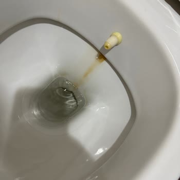 Aşırı Ücretli Hastanede Kötü Bakım Ve Eski Tesis Şikayetleri