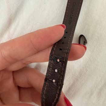 Deri Kordonun Hızlı Bozulması Ve Mağaza Desteksizliği