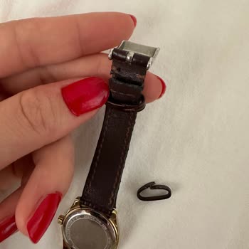 Deri Kordonun Hızlı Bozulması Ve Mağaza Desteksizliği