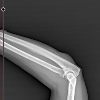 Palm Wings Ephesus Kaygan Havuzda Düşen Misafire Yetersiz Güvenlik Ve Saygısız Davranış