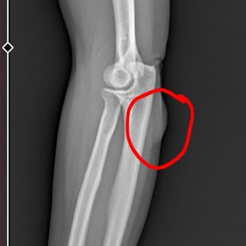 Palm Wings Ephesus Kaygan Havuzda Düşen Misafire Yetersiz Güvenlik Ve Saygısız Davranış