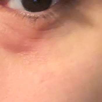 Dt. Semih Özkan Kanalımın Tamamlanmaması