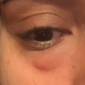 Dt. Semih Özkan Kanalımın Tamamlanmaması