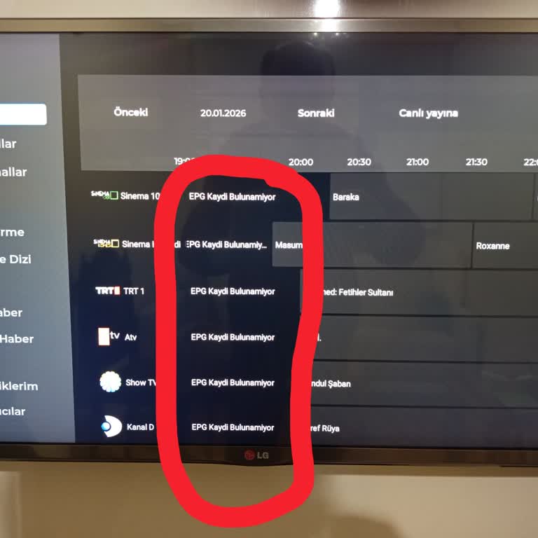 TV Her Yerde Sürekli Teknik Sorunlar Ve Çözüm Talebi