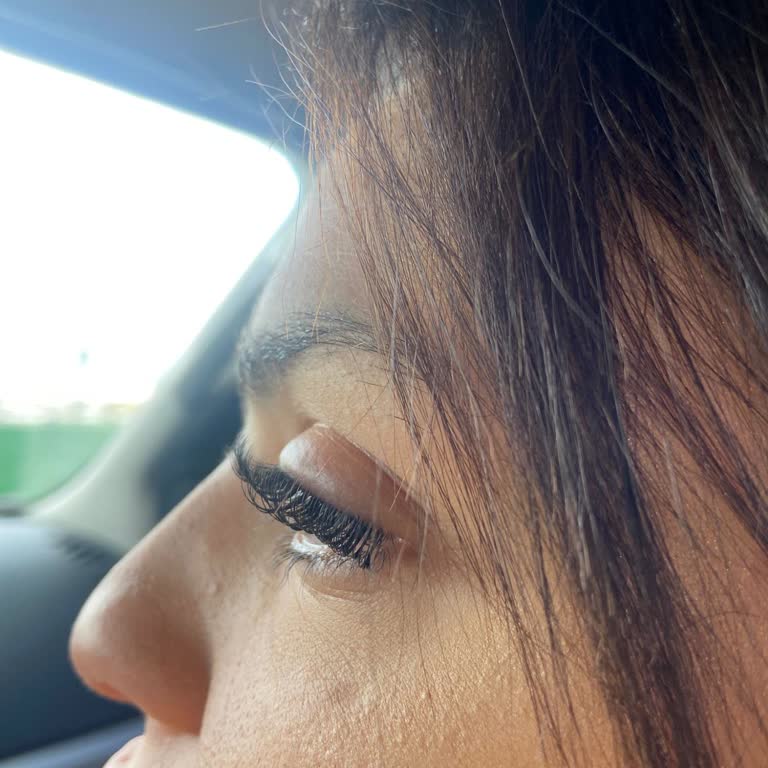 Setu Güzellik (İzmir) İpek Kirpik Uygulamasında Göz Şişmesi Ve Sağlık Riski