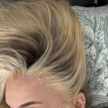 Mamak'ta Kuaförde Ombre İşlemi Sonrası Saç Yanığı Ve Aşırı Ücret