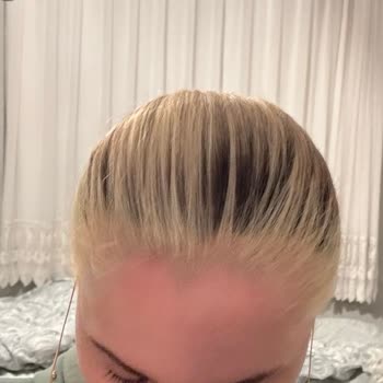 Mamak'ta Kuaförde Ombre İşlemi Sonrası Saç Yanığı Ve Aşırı Ücret