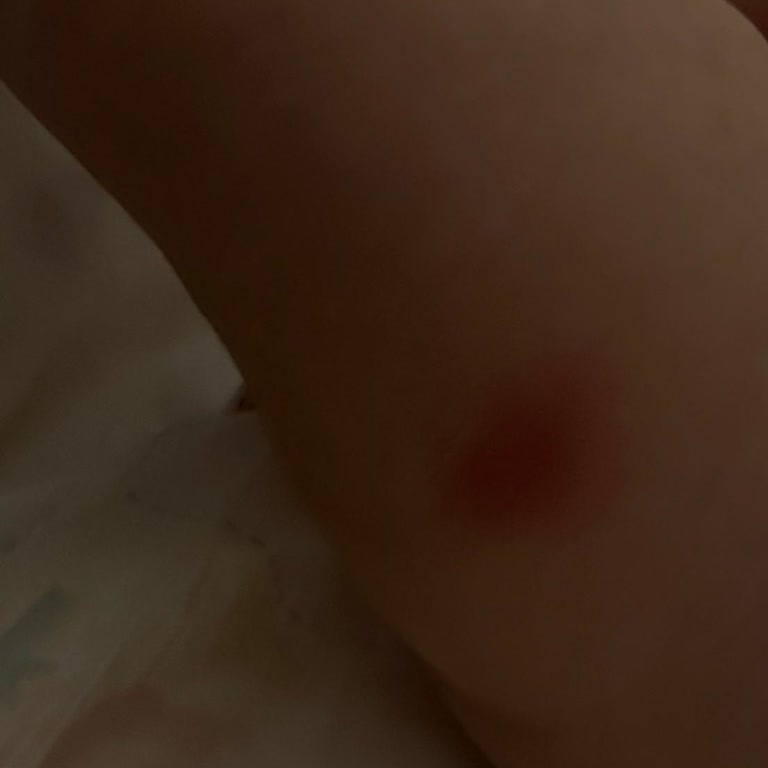 Aşı Uygulamasındaki Hatalı Uygulama Ve Ücretlendirme Sorunu