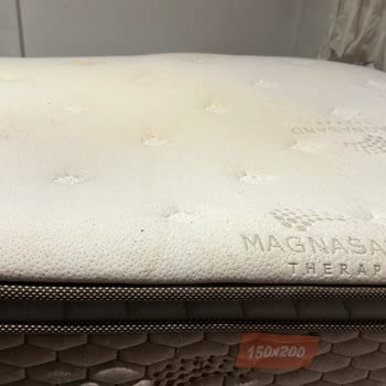 Bambi Yatağındaki Çökme Bel Fıtığına Yol Açtı