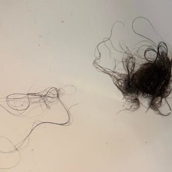 Elidor Setinde Şiddetli Kepek, Saç Dökülmesi Ve Rahatsız Edici Koku!