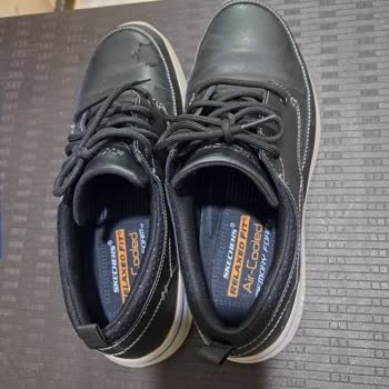 Skechers Ayakkabısının Kendi Kendine Deforme Olması Ve Yetersiz Tazminat Teklifi