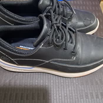 Skechers Ayakkabısının Kendi Kendine Deforme Olması Ve Yetersiz Tazminat Teklifi