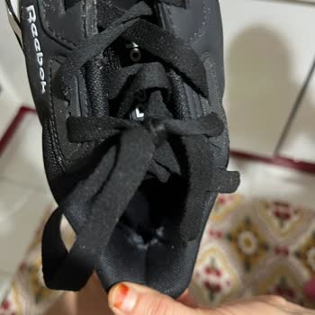 Reebok Ayakkabısının Topuk Deformasyonu Ve Enfeksiyon Nedeniyle Sağlık Sorunu Ve İade Talebi