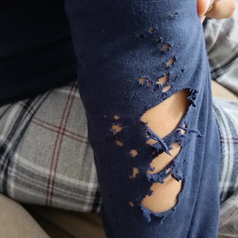 Bir Gecelik Kullanımda Pijama Takımında Delik Ve Yırtılma: Kalite Sorunu