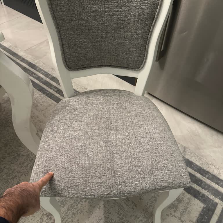 Hatalı Sandalye Çocuğumun Bacağını Vida İle Yaraladı: Servis Cevap Vermiyor