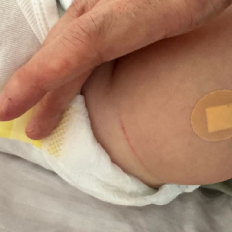 Bebek Bezi Bacağını Kesti: Hızlı İnceleme Ve Özür İsteği