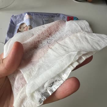 Baby Me Islak Mendilde Folyo Parçası Keşfi Hijyen Ve Güvenlik Sorunu