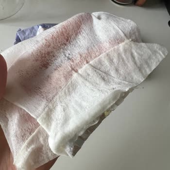 Baby Me Islak Mendilde Folyo Parçası Keşfi Hijyen Ve Güvenlik Sorunu