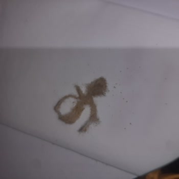 Gıda Ürününde Yabancı Madde Tespiti Ve Sağlık Endişesi