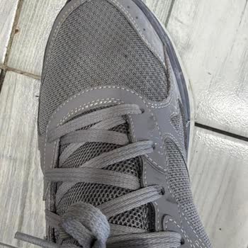 Skechers Ayakkabısının Üst Kısmının Açılması Ve Mağaza Tarafından Kullanıcı Hatası İddiası