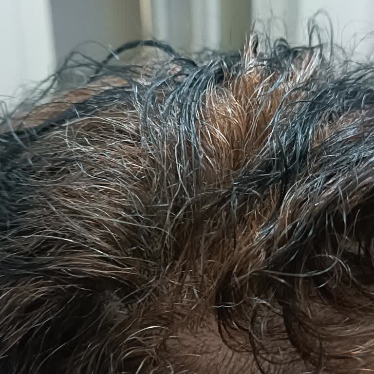 A101'de Satın Alınan Saç Boyasında Renk Uyuşmazlığı