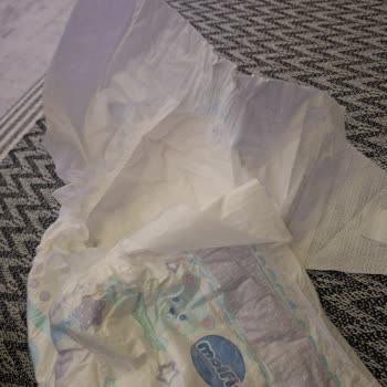 Molfix Bebek Bezinde Üretim Hatası: Yapışkan Bölüm Eksik, Değişim Ve İade Talebi