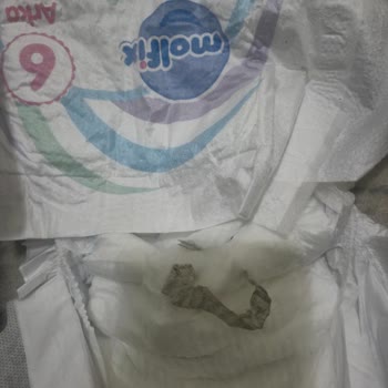 Molfix Bebek Bezinde Gizli Siyah Yabancı Parça Hijyen İhlali