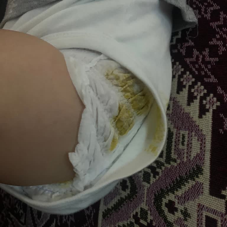 İlk Kullanımda Sızdıran Prima Premium Care 4 Numaralı Külot Bezi