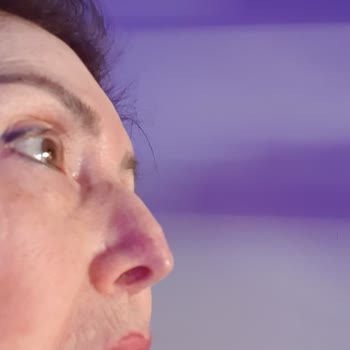 İzmir Ekol Hastanesi'nde Burun Estetiği Sonrası Cadı Burnu Ve Tekrarlanan Ameliyat Hataları