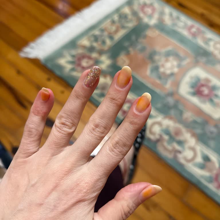 Flormar Kırmızı Oje Kullanımından Sonrası Tırnaklarda Sararma Ve Lekelenme Sorunu!