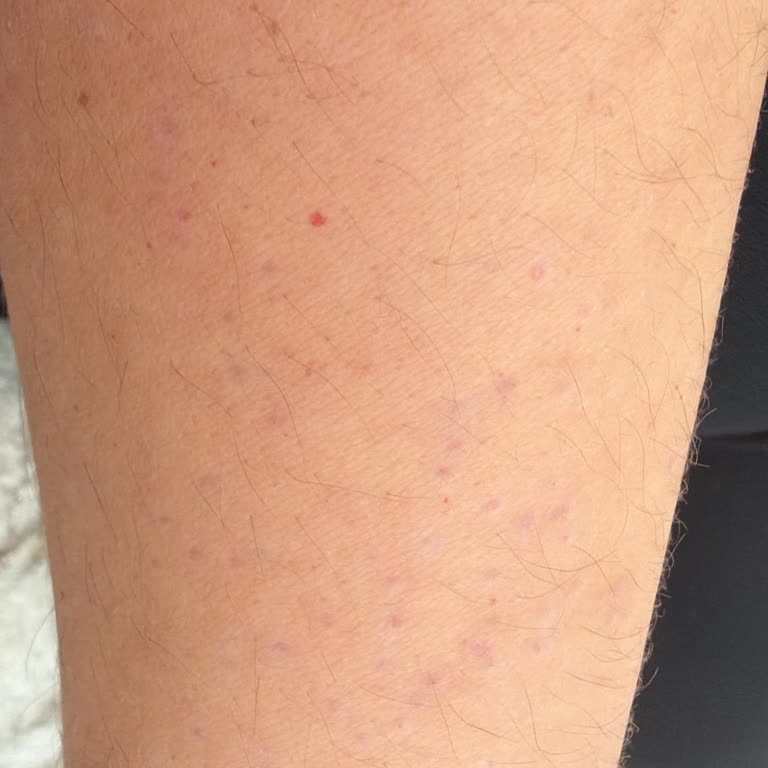 Nurhan Abdullahoğlu Beauty Epilasyon Mağduriyeti