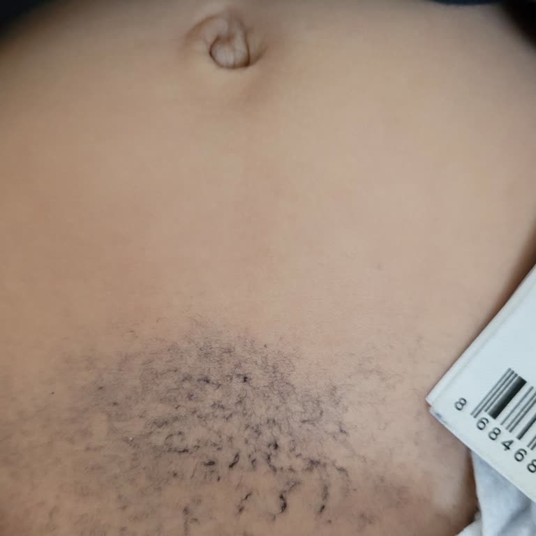 LCW Çocuğumun Cildinde Tüylenme: Zıbın Takımlarının Kalitesizliği Ve Değişim Talebi