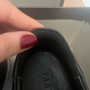 Ayakkabının Üretim Hatası Yara Açtı, Müşteri Hizmetleri Çözüm Sunmadı