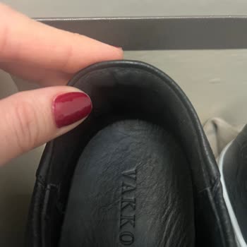 Ayakkabının Üretim Hatası Yara Açtı, Müşteri Hizmetleri Çözüm Sunmadı