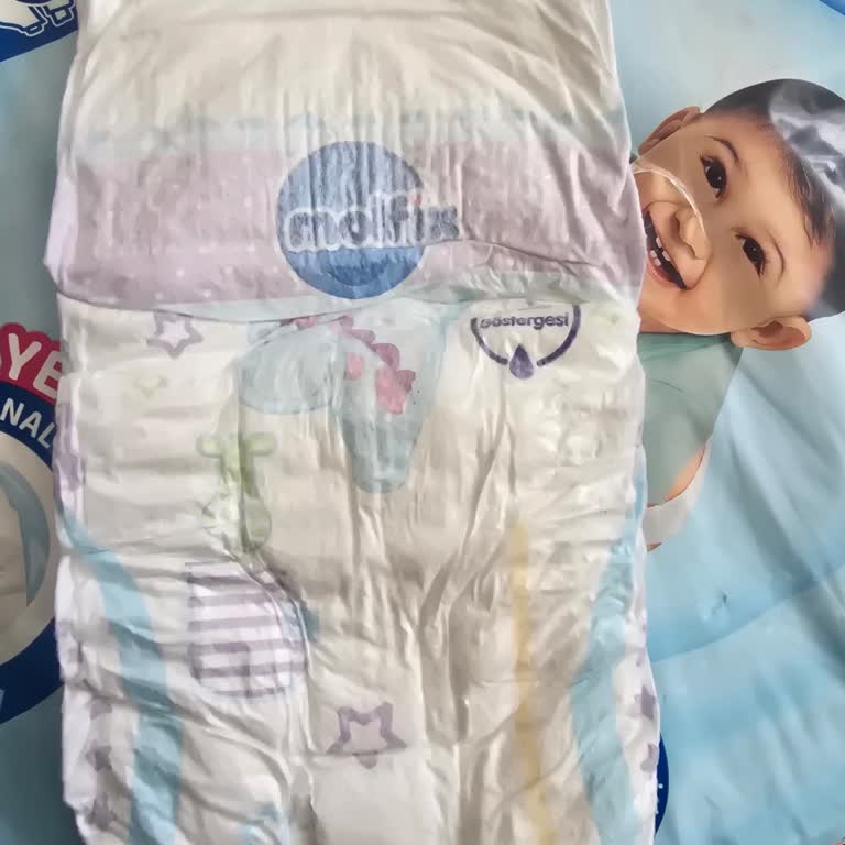 Elazığ'daki Markette Molfix 5 Junior Bebek Bezinde Üretim Hatası