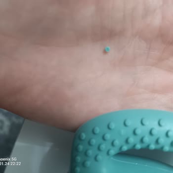 Bebek Güvenliğini Tehlikeye Atan Diş Kaşıyıcı