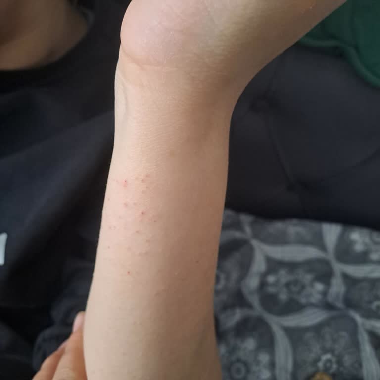 Peros Deterjanı Nedeniyle Şiddetli Alerjik Reaksiyon Ve Müşteri Hizmetlerinden Cevapsızlık