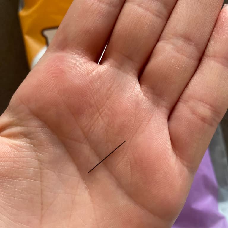 Lux Pamuk Ürünün İçinden Çıkan İğne Ciddi Güvenlik Sorunu