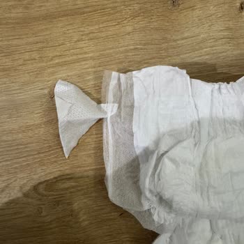 Molfix Bebek Bezlerinde Yan Bantların Yapışmaması Sorunu Tekrar Yaşandı